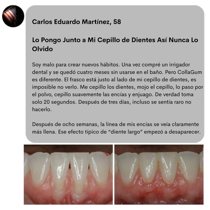 CollaGum™- Colágeno Directo Para Tus Encías